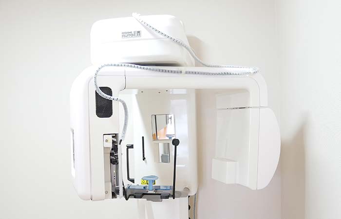 デジタルレントゲン