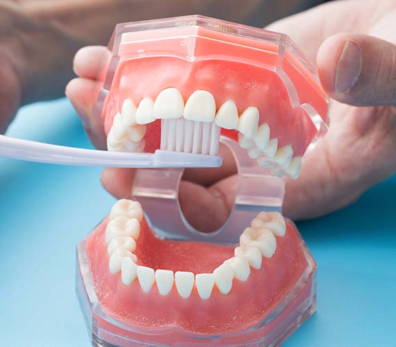 予防・クリーニング