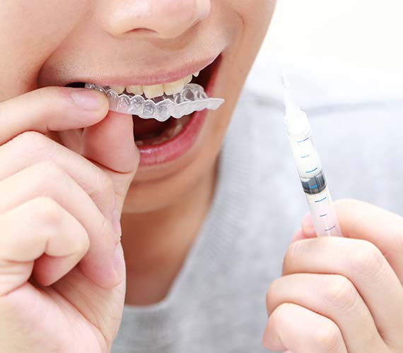 ホワイトニング